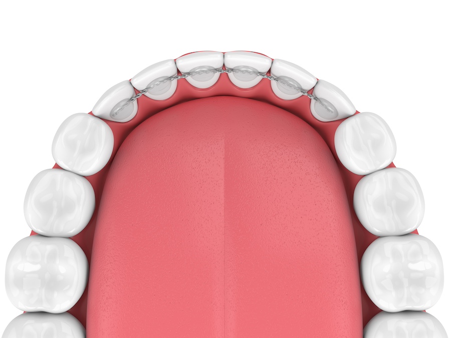 Emergency Dental of Virginia Beach