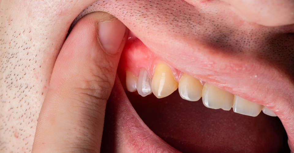 Emergency Dental of Virginia Beach
